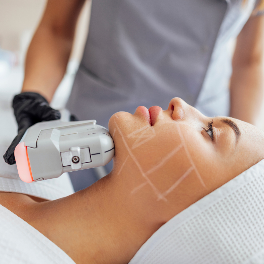 Tratamento HIFU-Ultrassom Microfocado