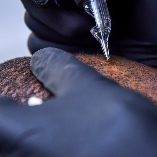 Micropigmentação Capilar