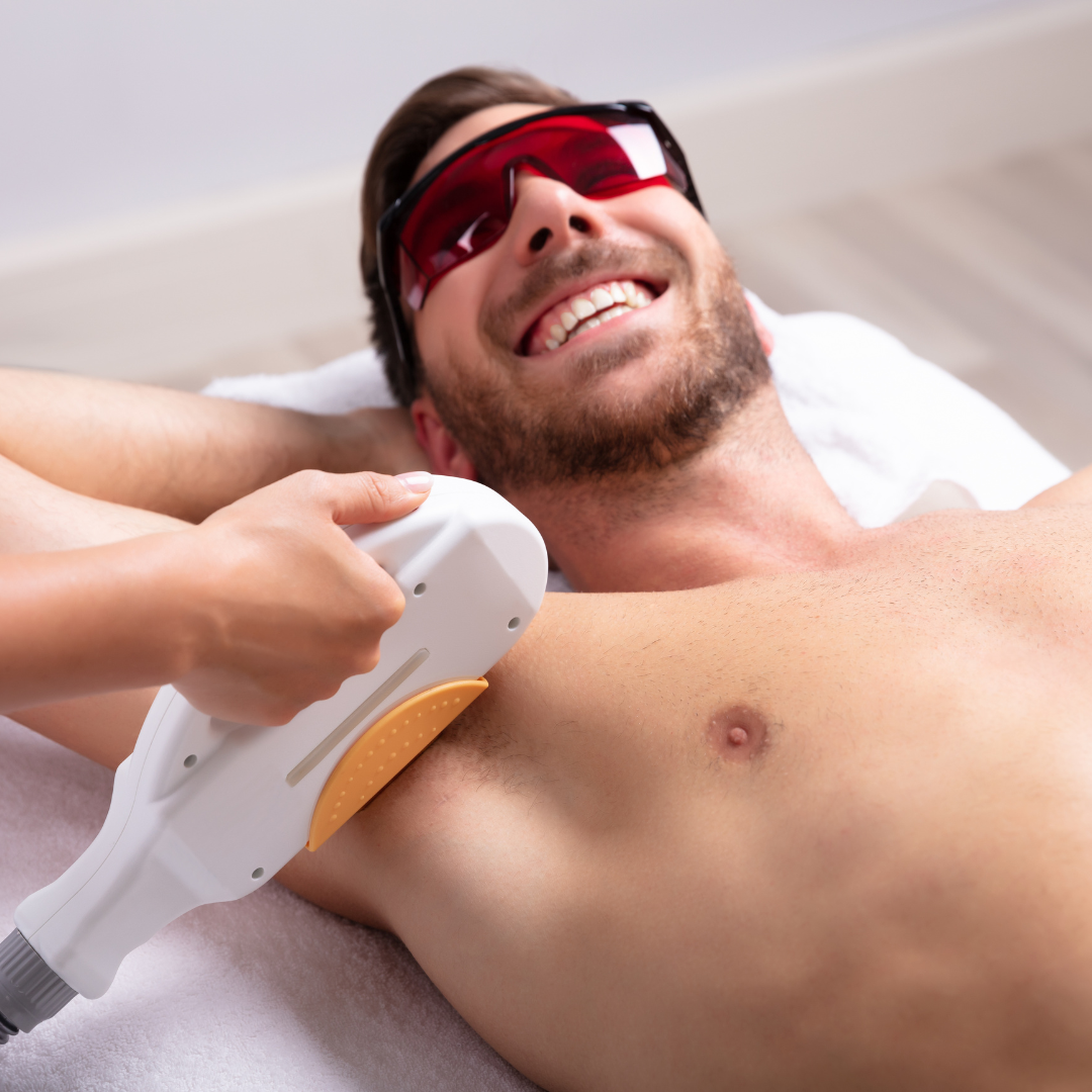 Depilaçã a Laser (Homem)