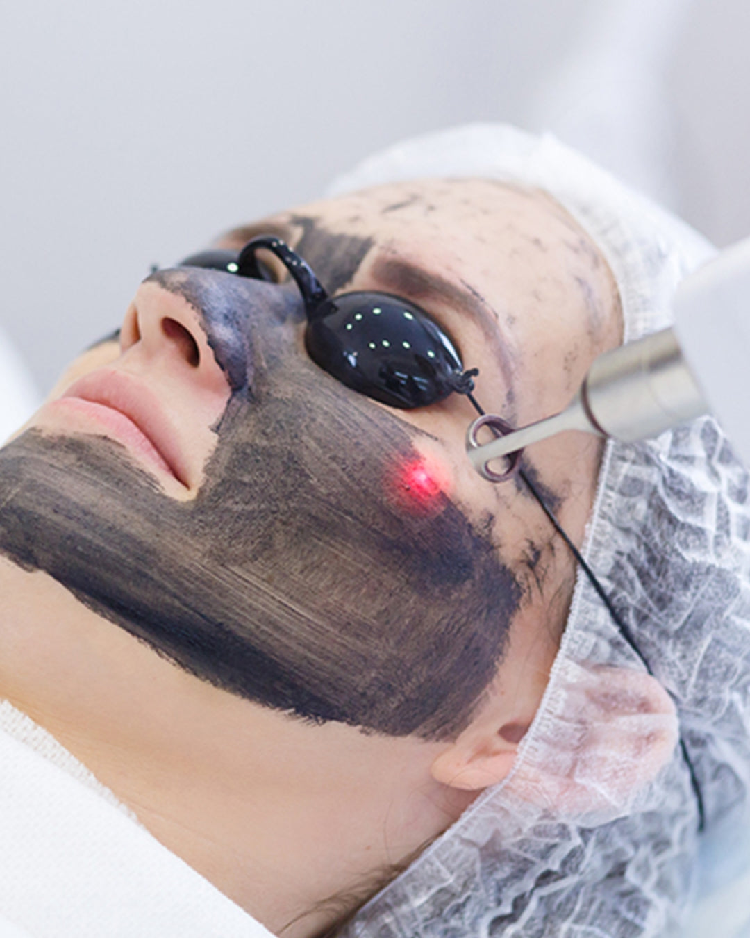 Formação Peeling Hollywood