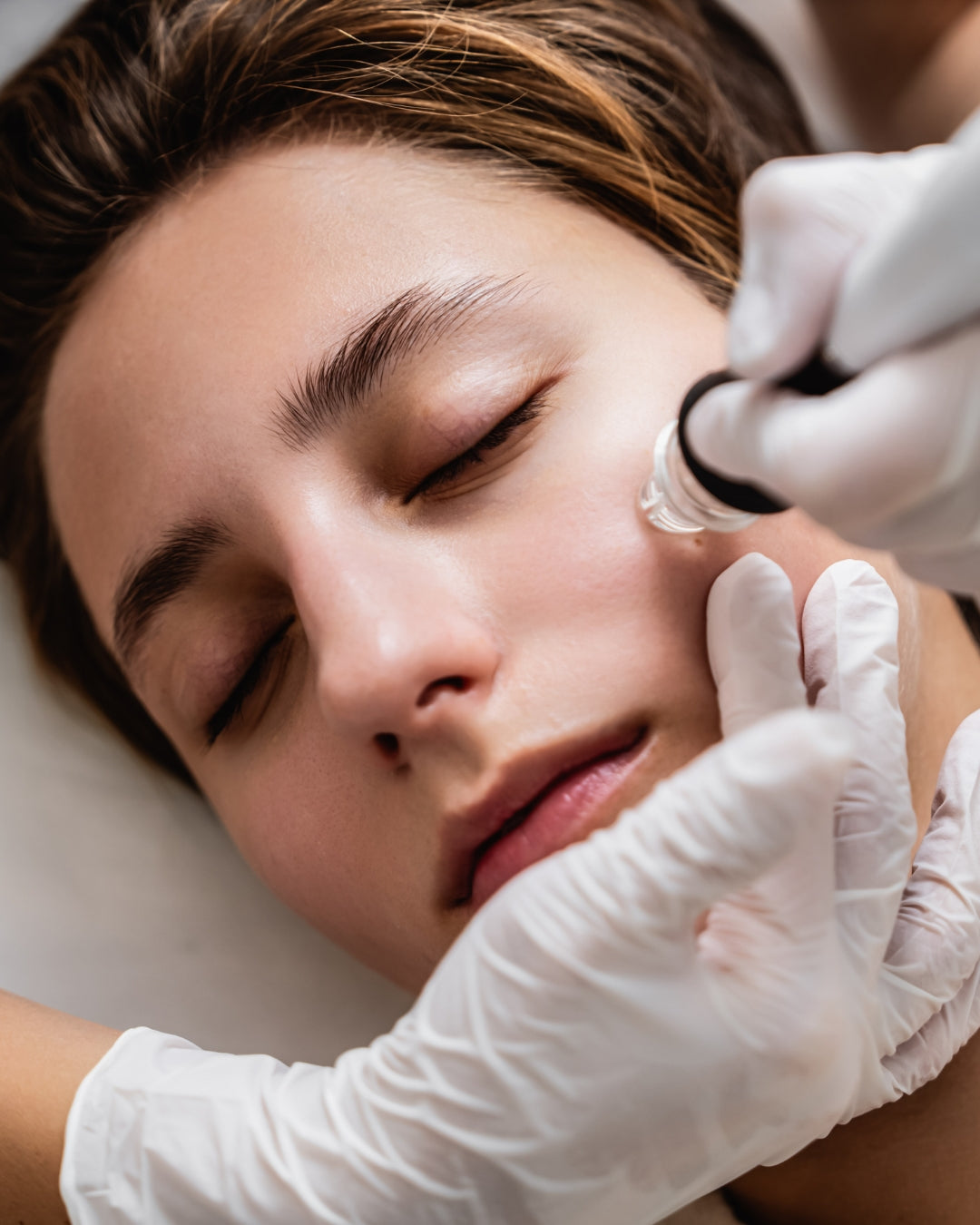 Formação Hydrafacial