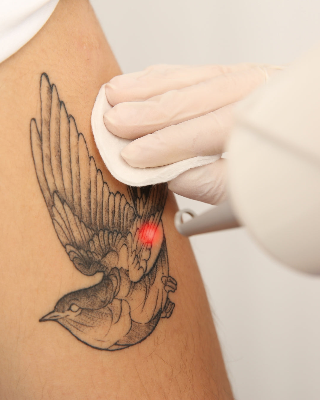Formação Laser Tattoo e PMU Removal